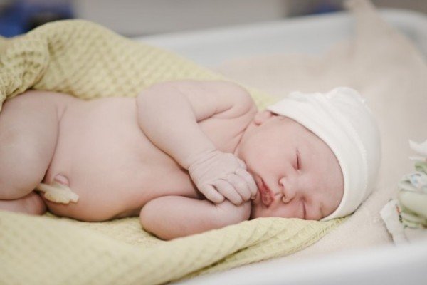 cordão umbilical newborn