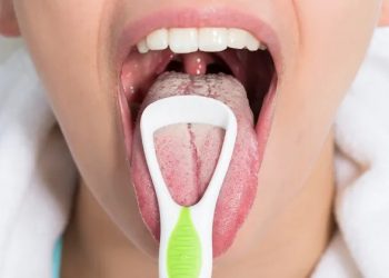 A importância da higiene bucal: alerta sobre as doenças que podem causar língua branca